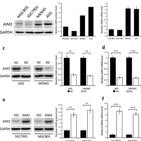 Knockdown And Overexpression Efficiency Of Aim In Gc Cell Lines A B