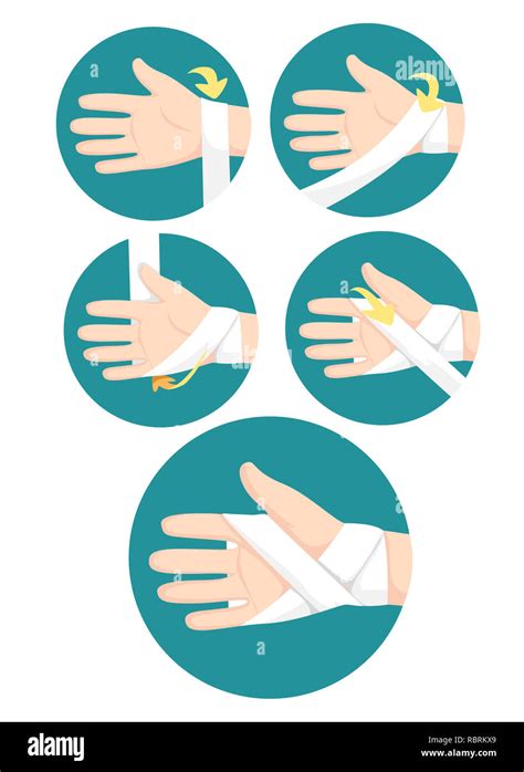 Illustration of Steps How to Apply Bandage Hands as First Aid Training ...