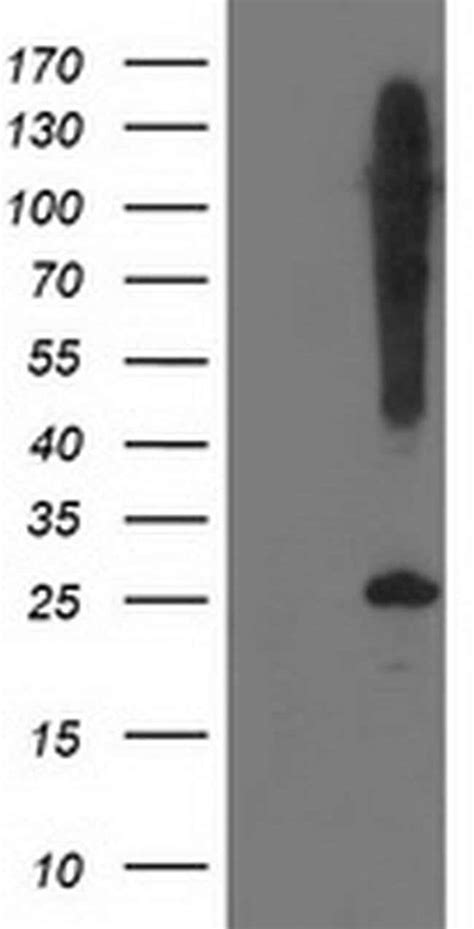 SNAP25 Monoclonal Antibody OTI 1D5 TrueMAB OriGene 100 μL