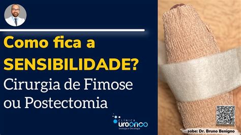 Como Fica A Sensibilidade Ap S A Cirurgia De Fimose Postectomia