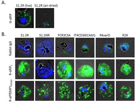 Indirect Immunofluorescence Micrographs A G Rif Igg Labelling Of