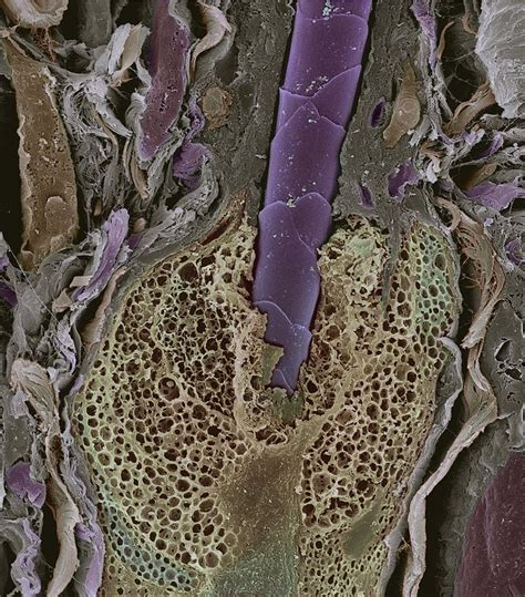 Hair Follicle Sem Photograph By Steve Gschmeissner