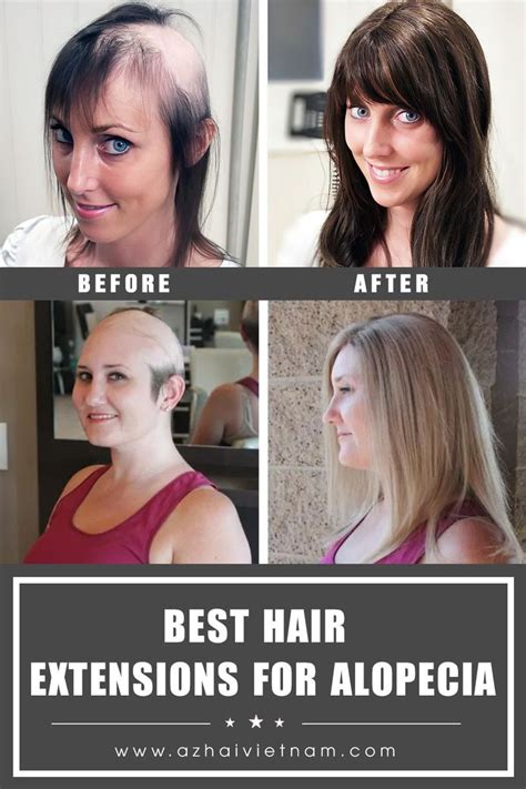 Best Hair Extensions For Alopecia Az Hair Hair Extensions Best