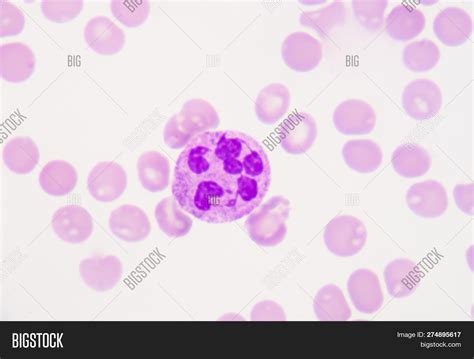 Segmented Neutrophil