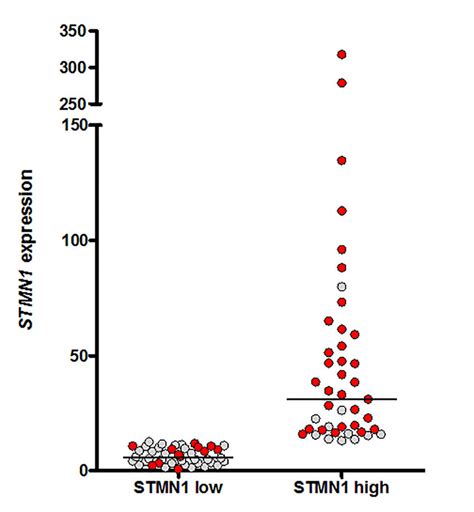 Stmn1 And Foxm1 Expression Analysis Of Our Gbm Cohort We Divided The