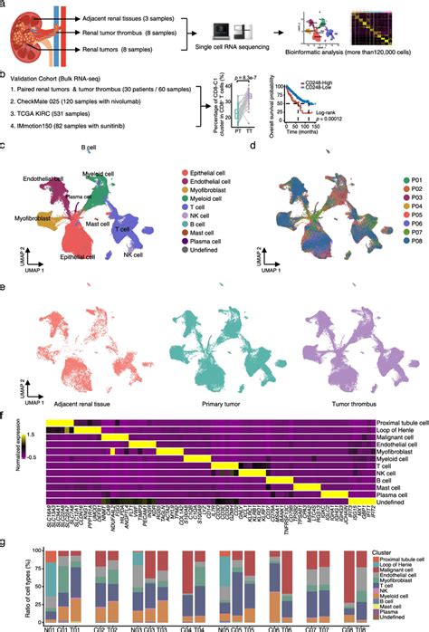 ScRNA Seq Profiling Of The Kidney Primary Tumors And Tumor Thrombus