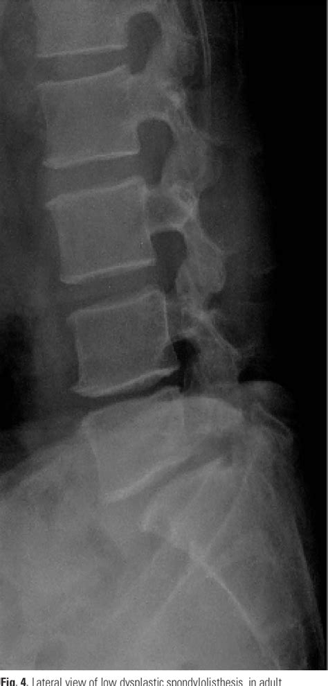 Figure 1 From Current Concept On The Classification And Treatment Of