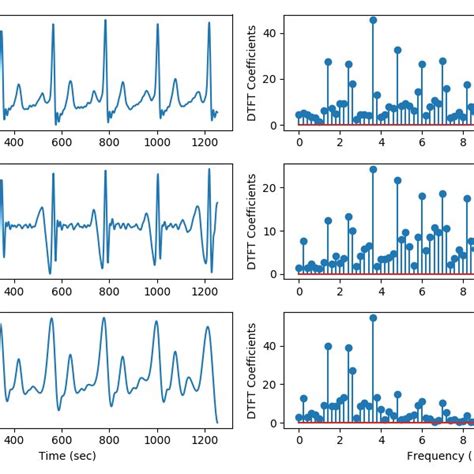 Signal Preprocessing And Filtering Step This Process Removes Most