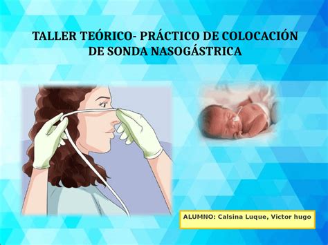 Colocaci N De Sonda Nasog Strico Practicas Res Menes De Enfermer A