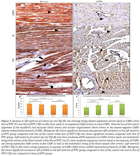 Thymoquinone Protects Against Hypothyroidism Induced Cardiac