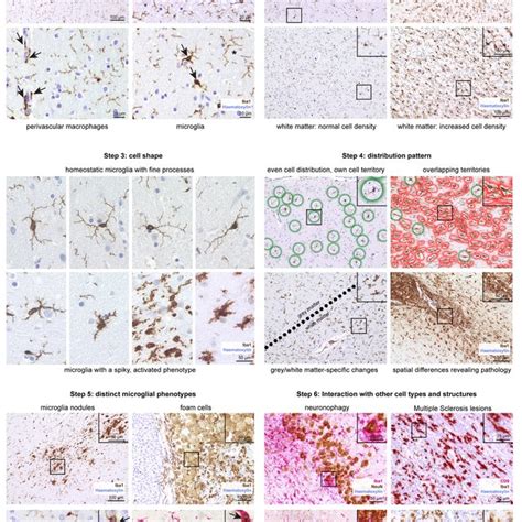 Immunohistochemistry Based Assessment Of Microglia Phenotypes Across