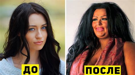 10 Жертв Неудачных Пластических Операций - YouTube