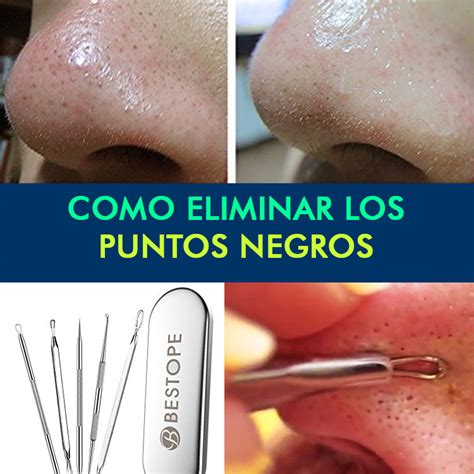 Álbumes 105 Foto Como Quitar Puntos Negro De La Nariz Con Pasta Dental