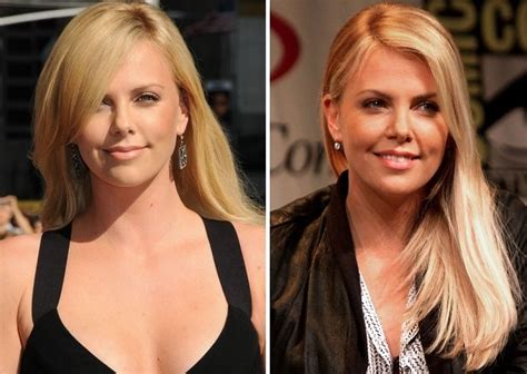 Charlize Theron Before And After Plastic Surgery