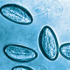 About Pinworm Infection (Enterobiasis)—Facts and Life Cycle