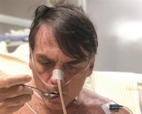 Intestino de Bolsonaro melhora e médicos retiram sonda diz boletim