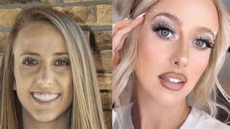 Brittany Mahomes Plastic Surgery Did She Get Lip Fillers And Breast