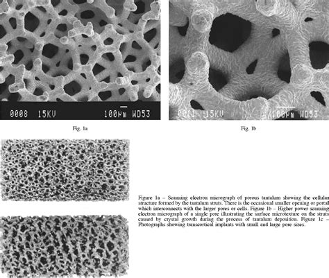 Figure 1 From Characteristics Of Bone Ingrowth And Interface Mechanics