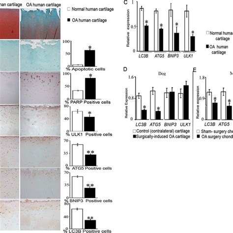 Increased Chondrocyte Apoptosis And Decreased Expression Of Autophagy