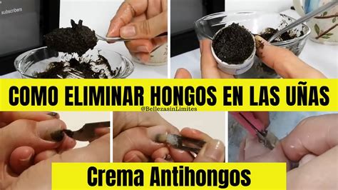 Crema Antihongos Como Eliminar Hongos En Las U As Y En La Piel Con