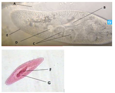 Biol227 Alveolates Ciliates Diagram Quizlet