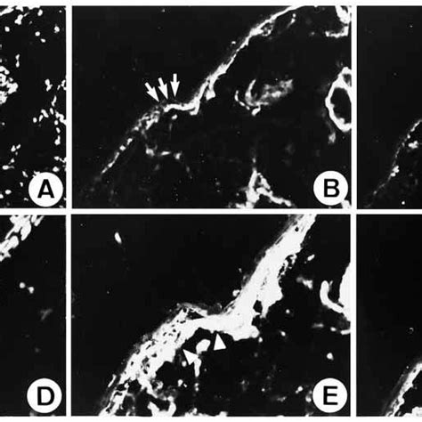 Immunolocalization Of Laminin 5 γ2 Epitope And Integrin α2β1 In