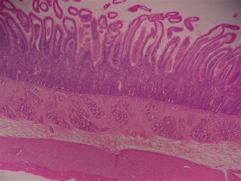 AMY 2B Exam 4 Duodenum Diagram Quizlet