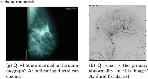 Figure From Overview Of The Vqa Med Task At Imageclef Visual