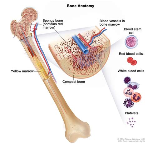 Bone Marrow Neoplasms