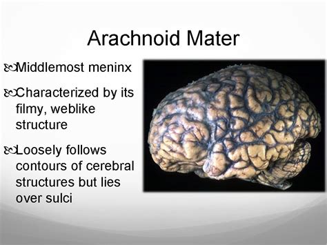 Encephalon Brain Brain Components Fig Brain