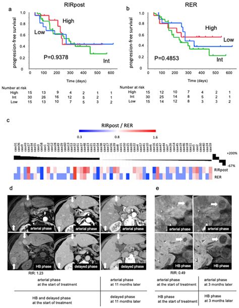 Evaluation Of Pfs Between Eob Mri Image Intensities In Atezo Bev