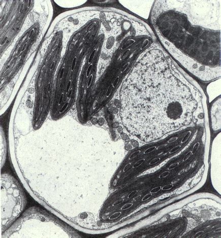 Mikelen Txokoa Dbh Biologia Zelulen Mikrografiak