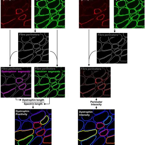 Dystrophin Immunofluorescence Analysis Results A Representative