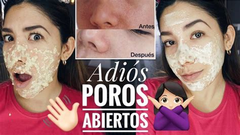 C Mo Hacer Una Mascarilla Casera Para Abrir Poros Y Eliminar Espinillas