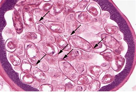 Pathology Outlines Whipworm