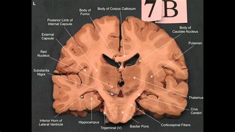 Neuroanatomy 3 Youtube Bank2home