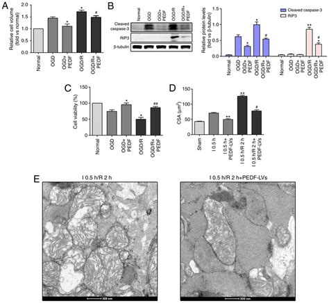 Pedf Inhibits Cardiomyocyte Edema And Injury In Ogd R A Cell Volume