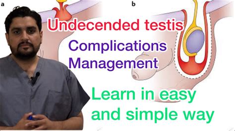 Undescended Testis Cryptorchidism Youtube