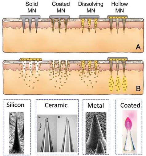 Microneedle Sensors For Multiplex Applications Toward Advanced