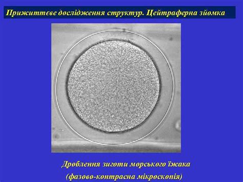 Мікроскопічні методи дослідження Види мікроскопії Світлова мікроскопія