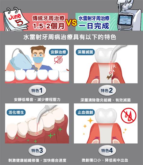 多麗美學牙醫診所 水雷射是什麼？一次了解水雷射牙周病治療原理、效果和優缺點