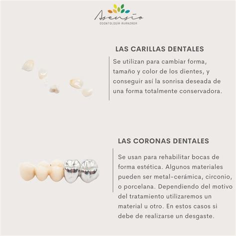 Conoces La Diferencia Entre Carillas Y Coronas Dentales Dental