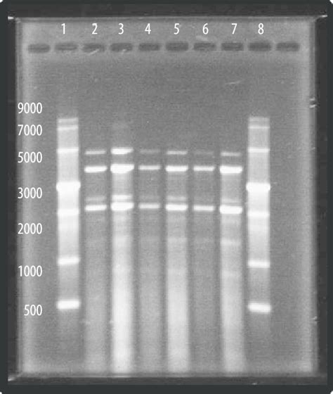 Agarose Gel Electrophoresis Of Yeast Rnas The Wells In A 12 Agarose Download Scientific