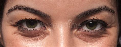 Eye Wrinkles Stock Image Image Of Eyelid Furrow Female 32800017