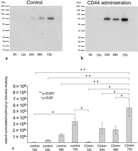 Western Blotting Of Phosphorylated Ezrin Protein In Control And Download Scientific Diagram