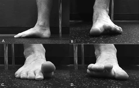 Evaluation Of Skeletal Muscle Activity During Foot Training, 42% OFF