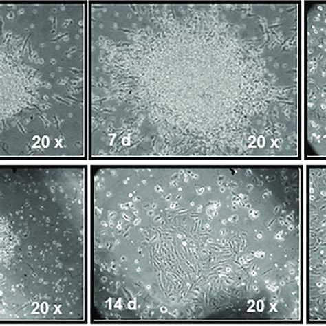 Colony Forming Units Endothelial Cells And Late Endothelial Colony