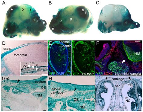 The Pax Lineage Contributions In The Cranial Region Lacz Yfp