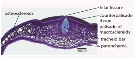 The types of sclereids present in the seed coat of the pulses, known ...