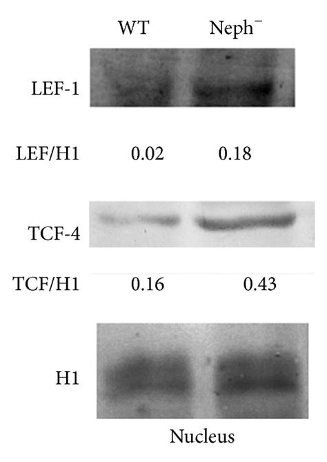 β Catenin Tcf 4 Lef 1 P53 And Prb Distribution And Expression In Download Scientific